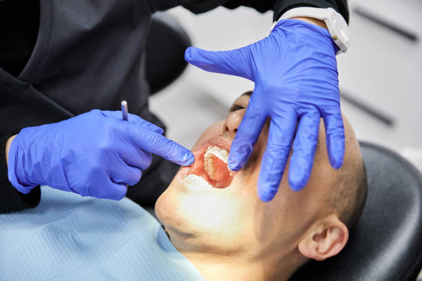 Tooth Infection Emergency Dentist in CA